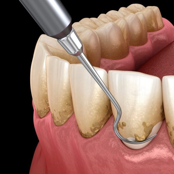 Periodoncia-TEMP